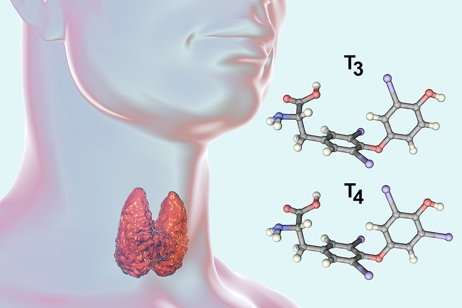 Compounded Thyroid Options for Optimal Hypothyroidism Treatment